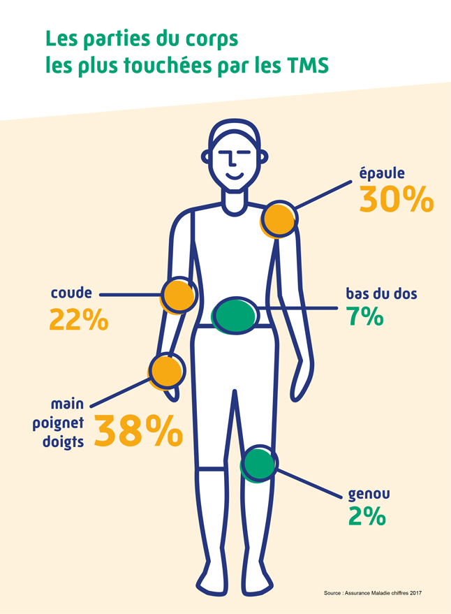 Guide De La Prévention Des TMS En Entreprise